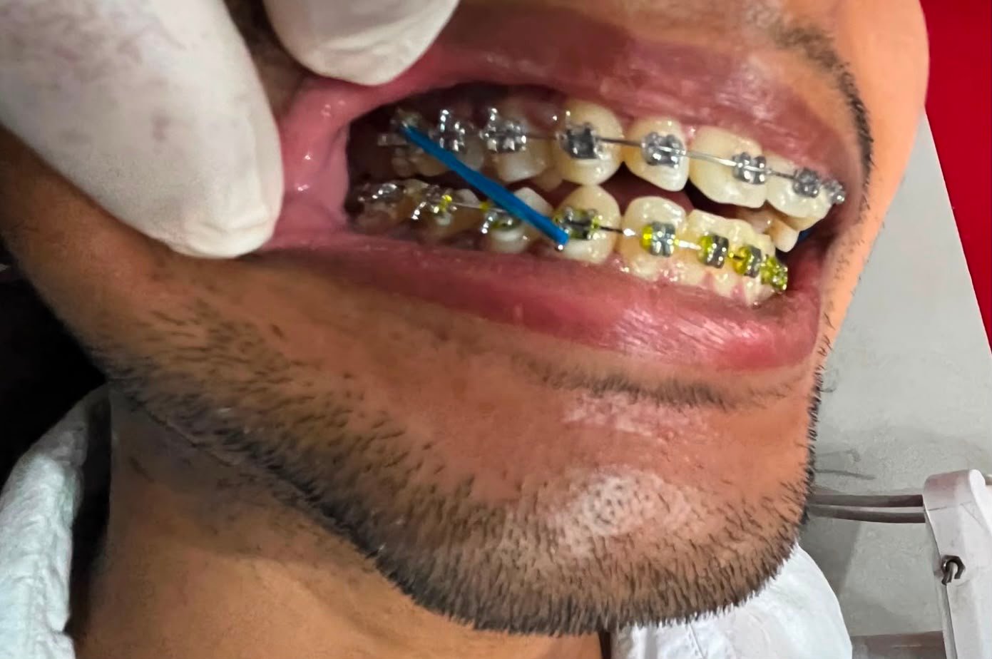 Smile Dental Clinic Results