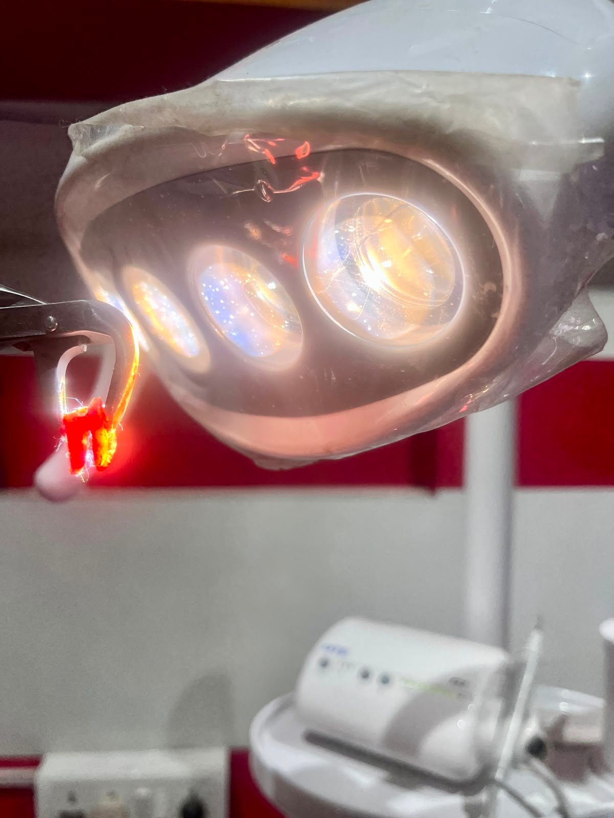 Smile Dental Clinic Results
