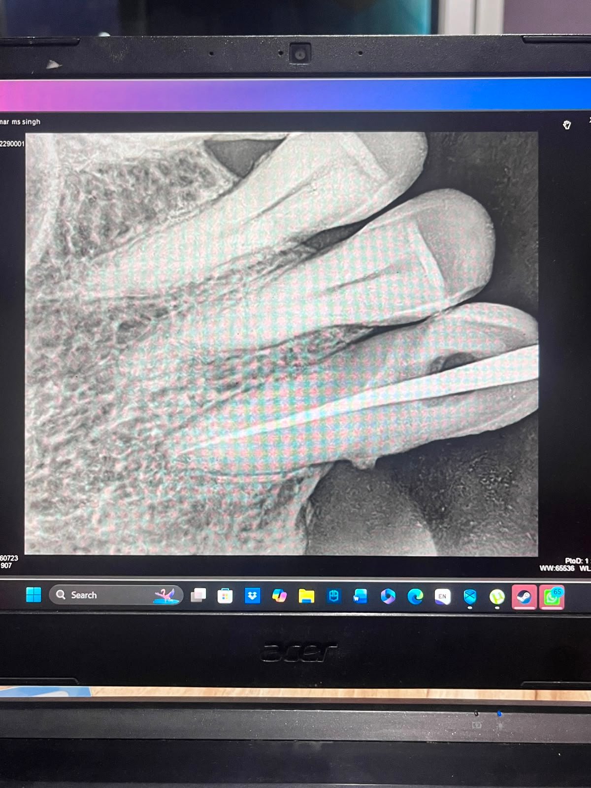 Smile Dental Clinic Results