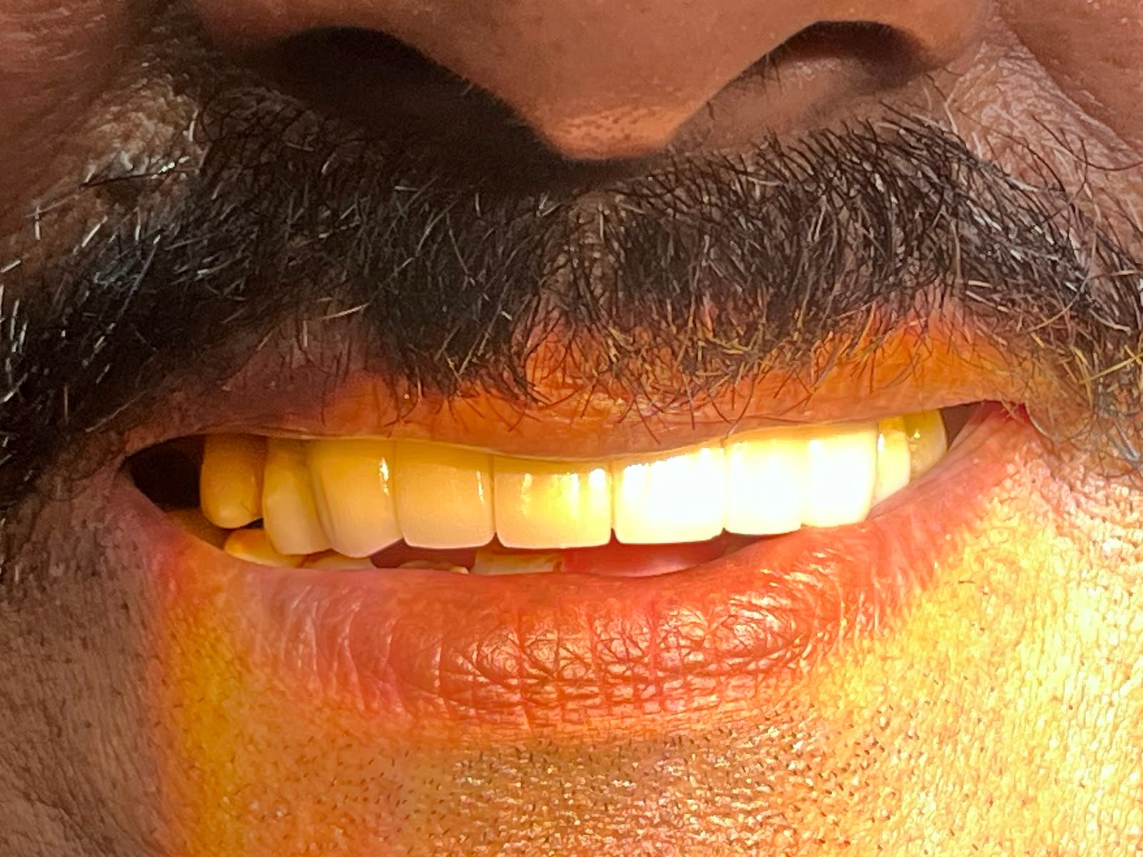 Smile