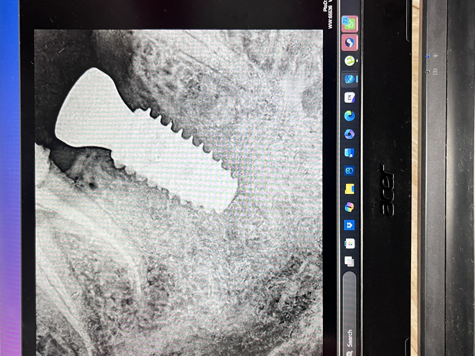 Dental Implant