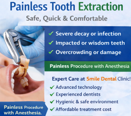 Painless Tooth Extraction