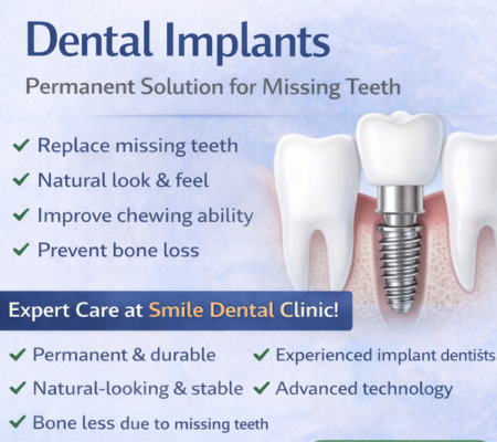 Dental Implants